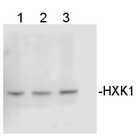 HXK1 | Hexokinase 1 (Chlamydomonas) in the group Antibodies Plant/Algal / Plant Developmental Biology / Plant Signal Transduction at Agrisera AB (Antibodies for research) (AS16 4083)